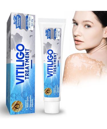 Vitiligo Treatment Anti Vitiligo Treatment Cream Improve Skin Pigmentation Effective Reduces and Fade Vitiligo