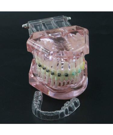 HDGRNCC Dental Orthodontic Brackets Model - Metal Ceramic Self-Ceramic Bracket for Training | International Shipping - Buy Online on GoSupps.com
