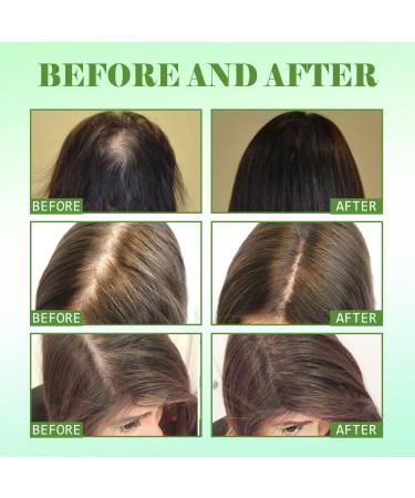 Rosemary Oil for Hair - 59ml | Nourishing Hair & Scalp Care Oil | Reduce Hair Loss & Promote Healthy Growth (2PCs) - Buy Online on GoSupps.com