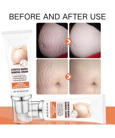 Stretch Mark Cream - Body Skin Care - Body Oil for Women - Firming & Lifting Body Oil - Stretch Marks Removal Skin Care Oil - Improves the Appearance of Stretch Marks Restore Skin Elasticity Body Oil - Buy Online on GoSupps.com