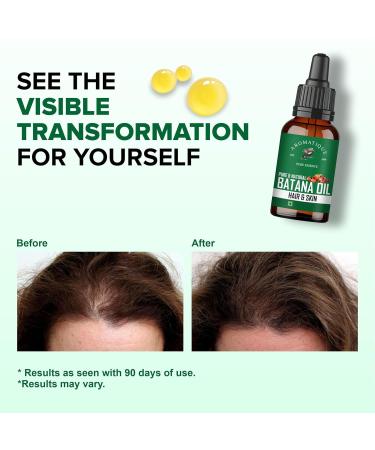 Arom atique Pure Batana Oil for Hair Growth - Cold Pressed Oil from Honduras 15 ML | Natural Hair & Skin Care - Buy Online on GoSupps.com