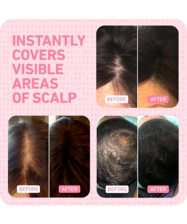 BOLDIFY Hairline Powder Instantly Conceals Hair Loss  Root Touch Up Hair Powder  Hair Toppers for Women & Men  Hair Fibers for Thinning Hair  Root Cover Up  Stain-Proof 48 Hour Formula (Light Blonde) - Buy Online on GoSupps.com