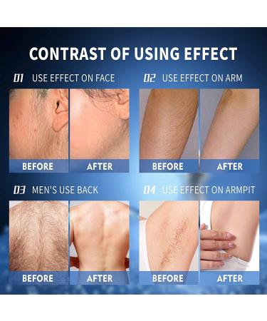 Natural Hair Inhibitor Spray - Stops Growth on Arm, Underarm, Legs, Face, Back, Chest, Bikini - Smooth Skin, Shrink Pores - For Men and Women - Buy Online on GoSupps.com
