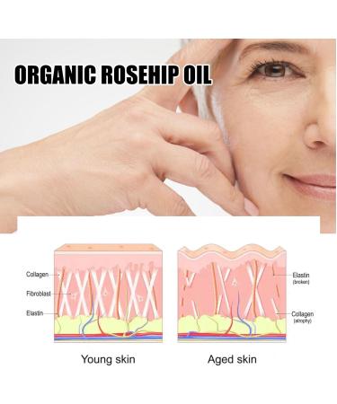 100% Organic Rose Seed Oil Cold-Pressed Rose Hip Oil Rosehip Oil for Face Facial & Body Oil for Women Moisturising Rose Oil Essential Oil Natural Rosehip Seed Oil Rose Hip Oil for Skin & Hair &Nails - Buy Online on GoSupps.com