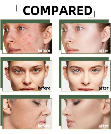 Hyaluronic Acid 2% + B5 Hyaluronic Acid Serum for Face Skincare Serum Face Serum for Women Hydrating Serum Hyaluronic Acid Moisturiser for Face Hydrated Brightening Serum to Plump and Smooth Skin - Buy Online on GoSupps.com