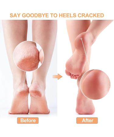 Gel Heel Protectors Pads - Pain Relief for Feet Pressure Sores, Heel Spur, Achilles Tendinitis - 2 Pair Pack - Buy Online on GoSupps.com
