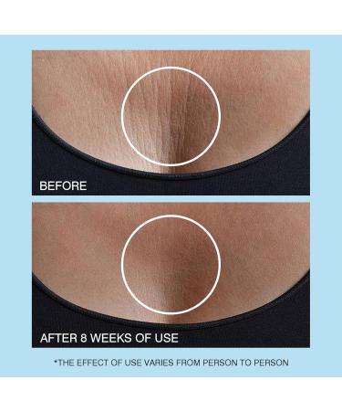Retinol Neck Cream - Hyaluronic Acid & Caffeine Enriched Neck Firming Cream | Anti-Aging 3-in-1 Moisturizing Cream to Minimize Fine Lines Dullness & Sagging Skin for Neck Chest & Face (50ml/1.7oz) - Buy Online on GoSupps.com