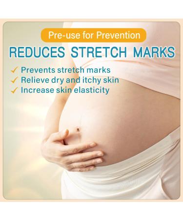 PEGO Pregnancy Stretch Mark Prevention Belly Cream with Shea Butter Body Oil Prevent & Reduce Stretch Marks During Pregnancy and Postpartum Massage Lotion Pregnancy Skin Care (300ml/1pack) - Buy Online on GoSupps.com