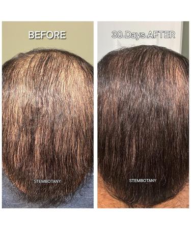 GHK-cu Copper Peptide Hair Regrowth Shampoo for Men & Women - Boost Hair Growth Nourish & Revitalize Shop Internationally - Buy Online on GoSupps.com