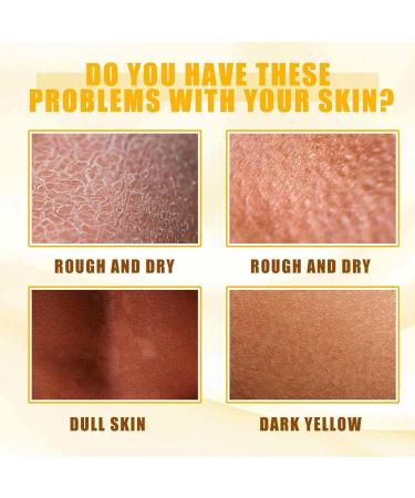Huile Eclaircissante peau Noire Peeling Visage Puissant Huile Gommage Peeling Corps Huiles Peeling Pour Le Corps Huiles De Peelings Jaune pied Hydratante limine Mortes Peau (1PC 30ML) 1PC 30 ml (Lot de 1) - Buy Online on GoSupps.com