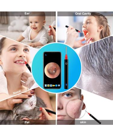 1080P HD Wireless Ear Wax Removal Camera Kit - Waterproof Otoscope Ear Cleaner with Light, 3.5mm Ear Endoscope for Smartphones & Tablets - Black - Buy Online on GoSupps.com