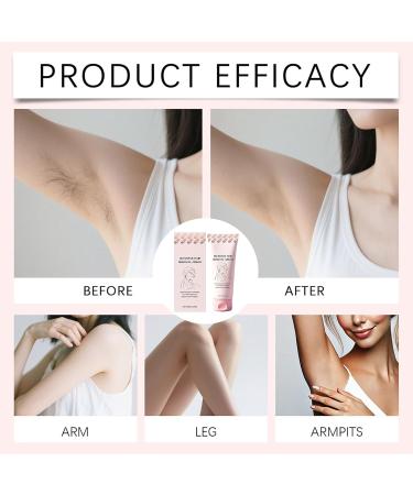  JINGLING JINGLING Body Hair Removal Cream 150g Nourishing Lotion Gentle Fast Odorless for Women Teenagers Legs Thighs Underarms Chest Intimate Areas - Buy Online on GoSupps.com