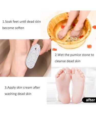 Pumice Stone Foot Scrubber Set - Callus Remover for Exfoliation | 4PCS Foot File for Feet, Hands & Body - Buy Online on GoSupps.com