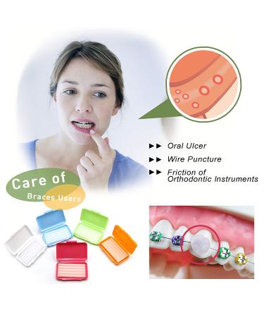 BRMDT Braces Wax 10Pcs - Moldable Orthodontic Wax for Retainers & Braces - Food Grade Material - Colorful Pack - Buy Online on GoSupps.com