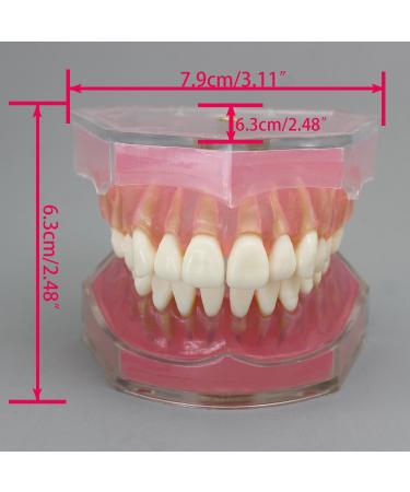 Dental Implant Teeth Model - Standard Study and Teaching Tool with Removable Teeth - Buy Online on GoSupps.com