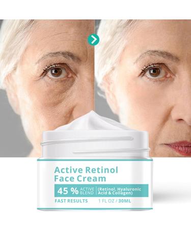  Generisch face moisturizer for women face moisturizer natural face moisturizer 30ml soothing cream for dry sensitive skin - Buy Online on GoSupps.com