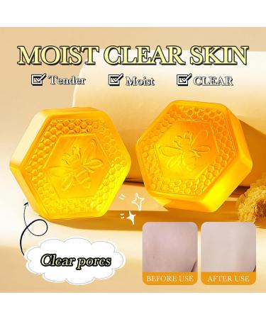 Honey Soap Bar - Vitamin E Bar Soap - Manuka Natural Body Soap Bar - Wash Hand Soap Bar Face Wash Clean Pore Dirt - Firm Lift Moisture Hydrate Oil Control - Smooth Tender Elasticity Complexion Radiant - Buy Online on GoSupps.com
