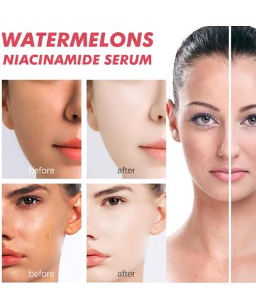 Watermelon Niacinamide Moisturizer Serum - Hydrating & Brightening Facial Serum with Hyaluronic Acid (Pack of 2) - International Shipping Available - Buy Online on GoSupps.com