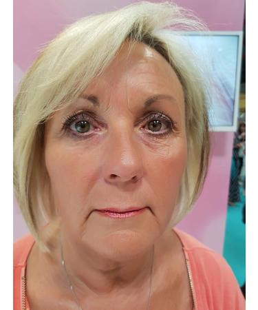 Eyesential 20ml Bottle: Removes Wrinkles, Puffiness, Dark Circles - Back in Stock - Buy Online on GoSupps.com