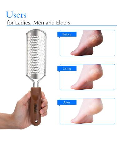 Professional Pedicure Foot File - Stainless Steel Detachable Scrubber for Hard Skin Removal - Wet and Dry Feet Pedicure Rasp - Buy Online on GoSupps.com