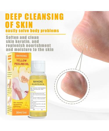 Extra Strength Yellow Peeling Oil 30ML - Lighten Dark Spots, Brighten Complexion - For Face & Body - Suitable for Dark Skin - Buy Online on GoSupps.com