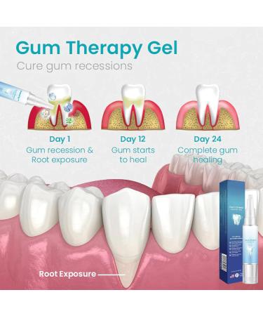 CEOERTY Gum Protection Therapy Gel & Tooth Whitening Set - Repair & Brighten Teeth | International Shipping - Buy Online on GoSupps.com