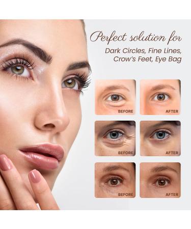Eye Serum Caffeine for Dark Circles | Retinol Eye Roller for Anti-Aging & Puffiness Treatment - Buy Online on GoSupps.com