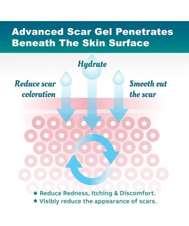 Advanced Scar Gel & Cream for Surgical Scars | C-Section Tummy Tuck Keloid Treatment - 50g - Buy Online on GoSupps.com