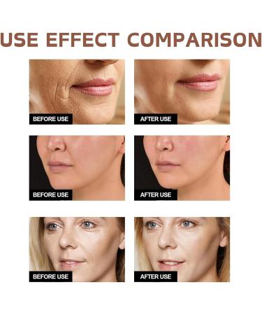 Retinol Serum for Face - Retionl Face Serum with Niacinamide - Anti-Aging & Anti-Wrinkle Face Serum for Women - Niacinamide Serum - Hydrating Serum - Dark Spot Remover for Face - Skin Care - Buy Online on GoSupps.com