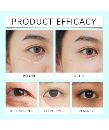 Reparative Eye Cream Anti Aging Under Eye Cream for Wrinkles & Fine Lines Reparative Eye Cream for Dark Circles and Puffy Eyes Eye Repair Cream Moisturising Cream for Eyes Firming Brightening - Buy Online on GoSupps.com