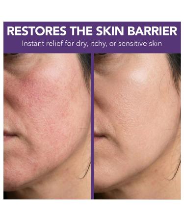 Intimate Rose Whipped Beef Tallow for Skin, Face & Body - Doctor Recommended 100% Grass Fed Balm with Organic Honey & Calendula - Natural Moisturizer for Dry Sensitive Skin - Unscented, 2oz. - Buy Online on GoSupps.com