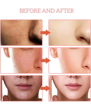 JASUAI Finones Skin Vitamin Serum 5in1 Vitamin C Facial Serum with Hyaluronic Acid AntiAging Hydration for Dark Spots Wrinkles Dull Skin Collagen Boost Facial Essence 1 Piece 1 Piece - Buy Online on GoSupps.com