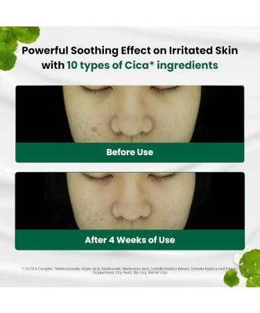 Dr.G Red Blemish Clear Soothing Korean Moisturizer Face Cream 70ml - Cica Cream Korean Skin Care Moisturizer Korean Face Moisturizer Facial Moisturizer Korean Skincare K Beauty Skincare Coreano - Buy Online on GoSupps.com