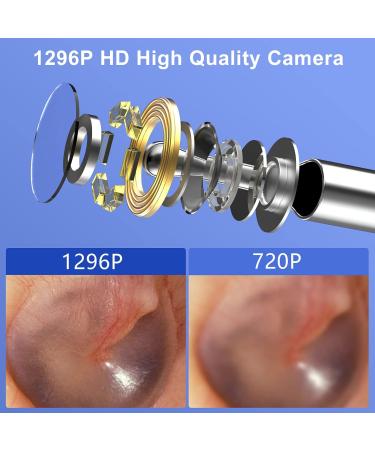 VITCOCO Ear Wax Removal Kit with 1296P Camera - Waterproof Endoscope for iPhone, iPad, Android - Ear Cleaner Tool - Buy Online on GoSupps.com