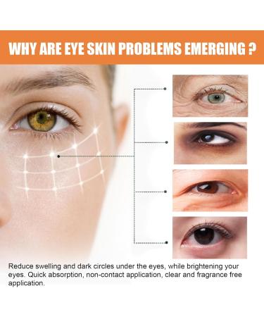  SKZKK Vitamin C Eye Balm Brightens & Reduces Puffiness Multi-Correxion Moisturizing Stick for Dark Circles and Puffiness Retinol - Buy Online on GoSupps.com