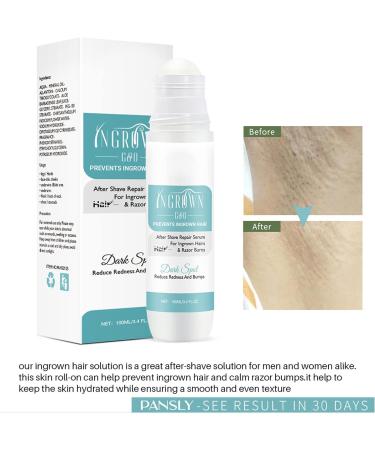 Tend Skin Ingrown Hair Solution - After Shave Treatment for Reducing Redness and Dark Spots - Buy Online on GoSupps.com
