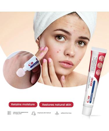 Anti Acne Face Cream Skin Care Beauty with Niacinamide & Vitamin C for Blackheads and Acne Prone Skin Removes Acne Redness Fade Dark Spots Correcting(20g) - Buy Online on GoSupps.com