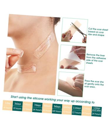 4pcs Silicone Scar Tape - Wound Repair Burn Scar Patches for Effective Scar Removal - Hemoton Silicone Sheet Care Supplies - Buy Online on GoSupps.com