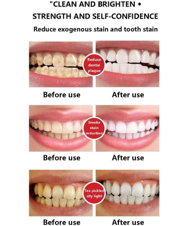 Whitening Probiotic Toothpaste - Deep Clean & Fresh Breath 2pc (120g) - Tartar Removal & Brightening Care - Buy Online on GoSupps.com