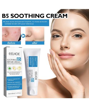 B5 Soothing Repairing Cream - Strengthen Skin Barrier Repair Acne-Prone Skin Improve Roughness | 40ml - International Shipping Available - Buy Online on GoSupps.com