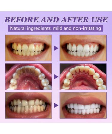 Ceboic Mineral Powder for Tooth Restoration 50g Mineral Powder for Tooth Restoration Natural Tooth Whitening Essence Effective in Strengthening Teeth and Gums Fresh Breath - Buy Online on GoSupps.com