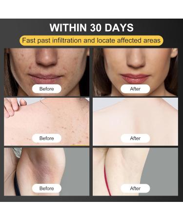 Bee Venom Cream Bee Venom Skin Treatment Natural Bee Venom Repair Cream for All Skin Types - Buy Online on GoSupps.com