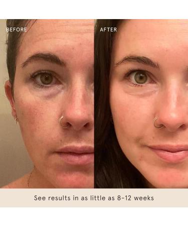 Barefaced Overachiever 1 Fl Oz 10-in-1 Skin Booster with Bakuchiol Resveratrol & Green Tea Retinol Alternative Hydrates Minimizes Pores & Fine Lines - Buy Online on GoSupps.com