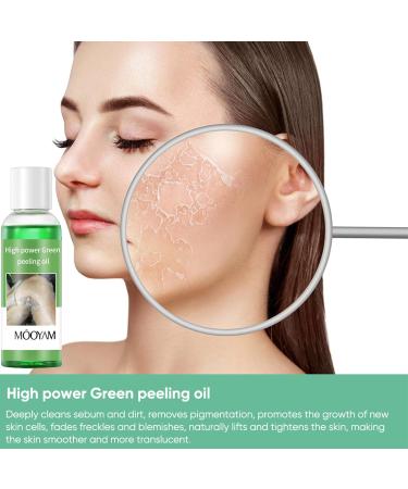 Extra Strength Peeling Oil for Dark Skin - 110ML | Chemical Peel for Face Hands & Feet - At Home Treatment - Buy Online on GoSupps.com