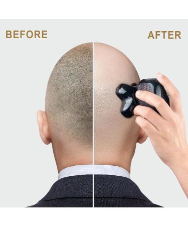 Telfun Detachable Head Shaver | Electric Head Shavers for Bald Men | 5-in-1 Cordless Razors for Men 100% Waterproof | Head Electric Razor with Nose Hair Trimmer Anti-Pinch Wet and Dry Shaving - Buy Online on GoSupps.com