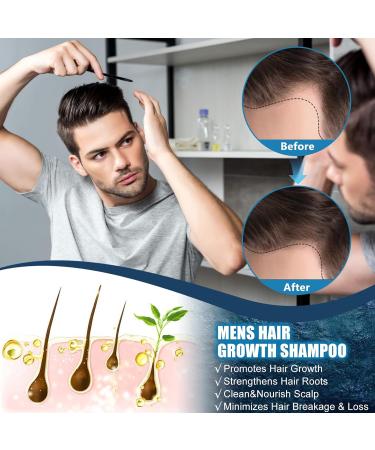 Xionghonglong Hair growth shampoo shampoo for men 100ml Shampoo against hair loss Promotes hair growth Strengthens the hair roots Cleans and cares for the scalp Reduces hair breakage and hair loss - Buy Online on GoSupps.com