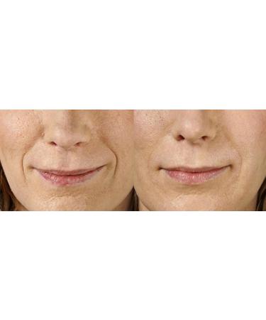 Buy Magic Serum - No Needle Anti-Aging Solution with BioActive Argireline & Peptides - Smooth Expression Lines & Creases - 1 oz - Buy Online on GoSupps.com