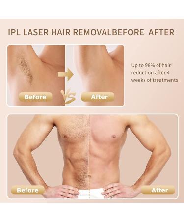 Sapphire IPL Hair Remover - 999 900 Pulses Freezing Point Tech 9 Energy Levels & 3 Functions for Body Face & Bikini Zone - Buy Online on GoSupps.com