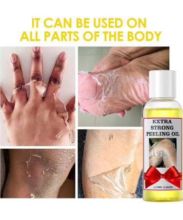Peeling Oil Yellow Peeling Oil for Dark Skin Peeling Oil Extra Strength Yellow Peeling Oil Extra Strong Skin Peeling Strong Peeling Oil Peeling Solution Body Peeling Oil 110ML/3.66 OZ 110 ml (Pack of 1) Yellow - Buy Online on GoSupps.com