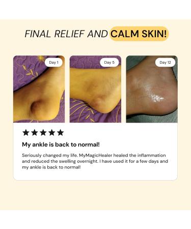 MyMagicHealer Comfrey & Arnica Salve | Natural Herbal Remedie for Body Tension & Comfort | 1 oz 1 Ounce - Buy Online on GoSupps.com